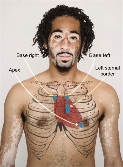 how do you assess a precordial lift.